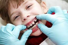 Tại sao trẻ em cần chỉnh hình răng càng sớm càng tốt?