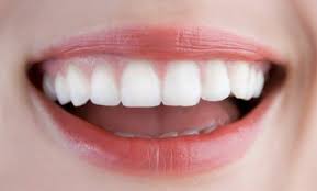 Tẩy trắng răng có bị ê buốt không?
