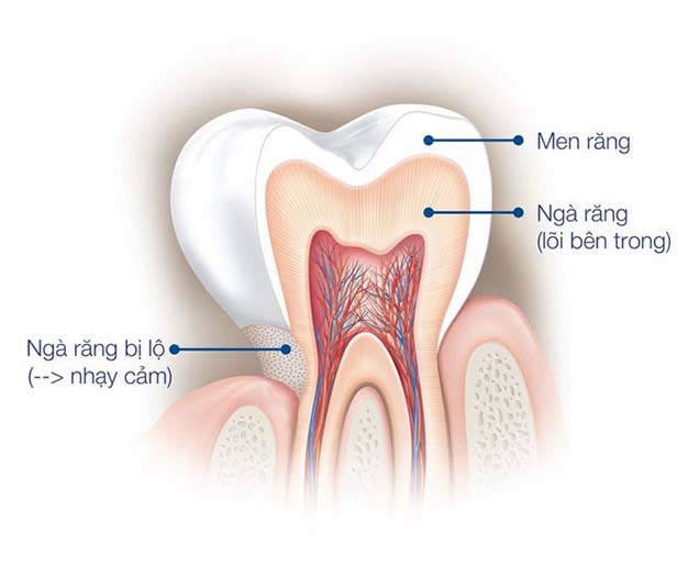 Tại sao men răng lại bị hư tổn?