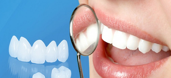Cách chăm sóc để giúp kéo dài tuổi thọ cho răng sứ thẩm mỹ