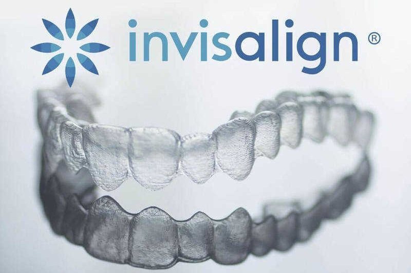 Câu Hỏi Về Invisalign Thường Gặp