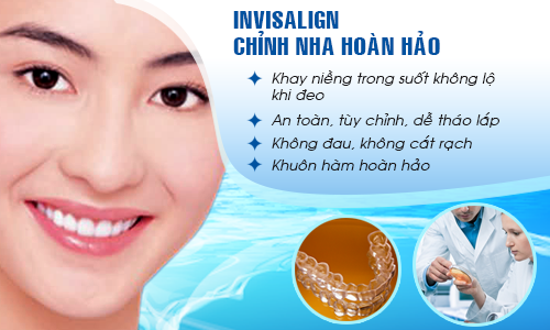 Lưu ý khi bạn niềng răng Invisalign