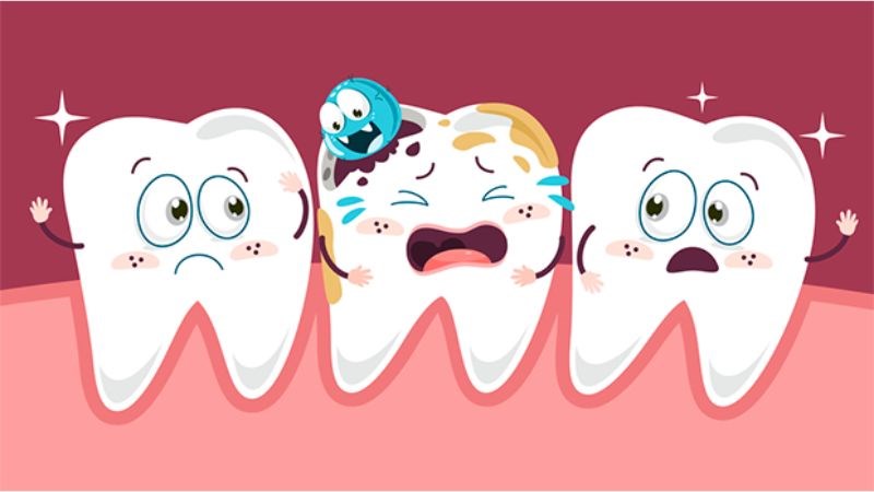 Bị sâu răng có lây sang răng khác không?